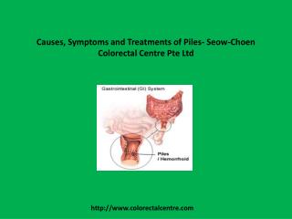 Causes, Symptoms and Treatments of Piles