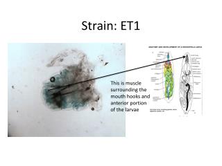 Strain: ET1