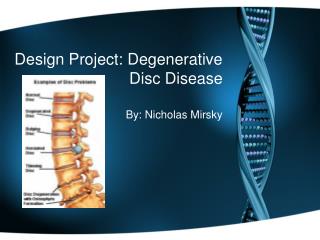 Design Project: Degenerative Disc Disease