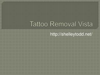 Tattoo Removal Vista.