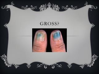 Gross?