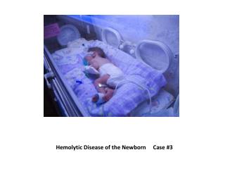 hemolytic disease of the newborn case presentation