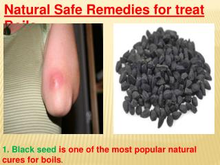 Natural Safe Remedies for treat Boils