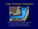 Upper Extremity Amputation