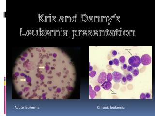 Kris and Danny’s Leukemia presentation