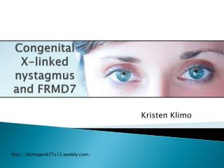 PPT - NYSTAGMUS PowerPoint Presentation - ID:1356516