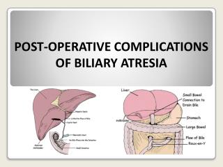 POST-OPERATIVE COMPLICATIONS OF BILIARY ATRESIA