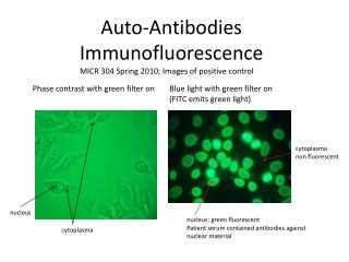 Auto-Antibodies Immunofluorescence