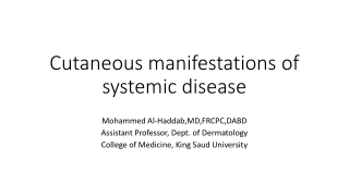 Cutaneous manifestations of systemic disease