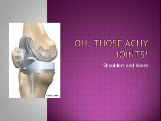Oh, those achy joints!