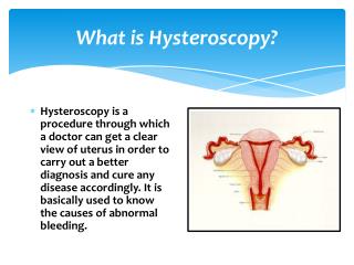 What is Hysteroscopy?