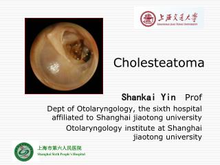 PPT - from tympanic retraction pocket to cholesteatoma PowerPoint ...