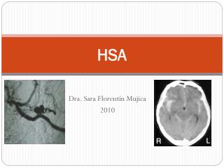 HSA