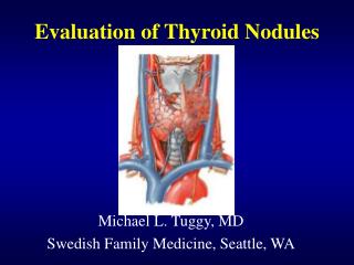 Evaluation of Thyroid Nodules