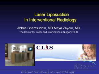 Laser Liposuction In Interventional Radiology