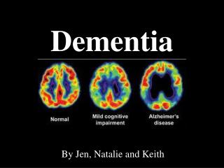 powerpoint presentations on dementia