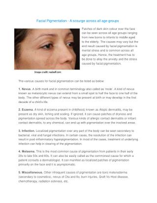 Facial Pigmentation – A scourge across all age groups