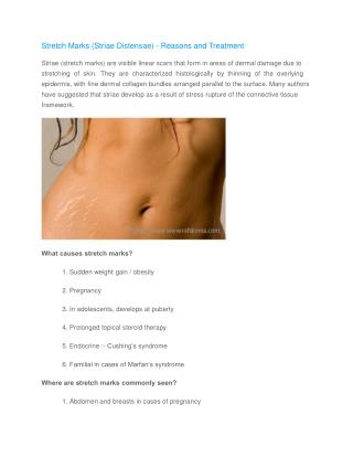 Stretch Marks (Striae Distensae) - Reasons and Treatment