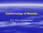 Epidemiology of Measles