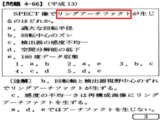 断層画像（ CT,SPECT,PET ）を得るためのフィルタは ２種類ある。 Pre-filter 　　前処理フィルタ 　断層画像の元になるプロジェクション像の雑音除去。