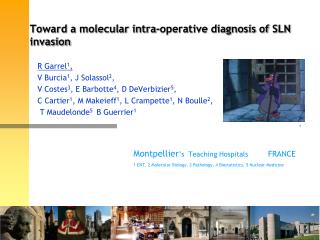 Toward a molecular intra-operative diagnosis of SLN invasion