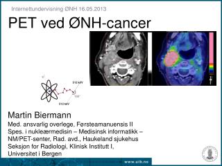PET ved ØNH-cancer