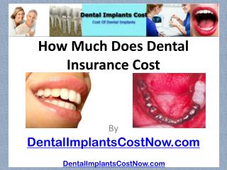 [How Much Does Dental Insurance Cost]