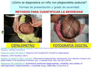 ¿Cómo se diagnostica un niño con plagiocefalia postural? Formas de presentación y grado de severidad METODOS PARA CUANT