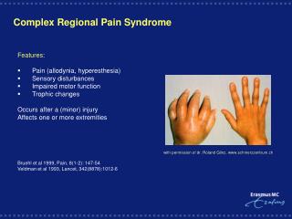 PPT - COMPLEX REGIONAL PAIN SYNDROME (crps) PowerPoint Presentation ...