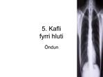 5. Kafli fyrri hluti