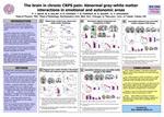 The brain in chronic CRPS pain: Abnormal gray-white matter interactions in emotional and autonomic areas