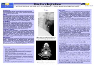 Hereditary Angioedema