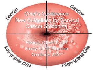 Chief’s Conference New Guidelines for Cervical Cancer Screening