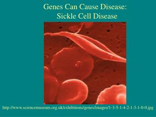 PPT - strokes in sickle cell disease: prevention and treatment 2nd pan ...