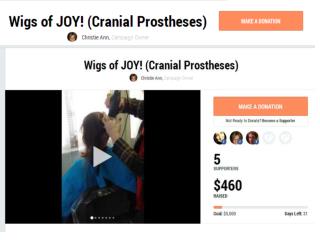 Wigs of JOY! (Cranial Prostheses),Chicago, IL – Make a donat