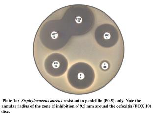 Plate 1c: Non-multiple resistant MRSA susceptible to cotrimoxazole
