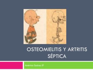 Osteomielitis y artritis séptica