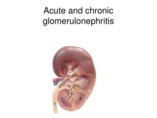 PPT - Acute and chronic glomerulonephritis PowerPoint Presentation ...