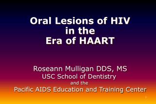 Oral Lesions of HIV in the Era of HAART