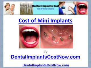 Cost Of Mini Implants