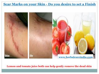 Scar Marks on your Skin - Do you desire to set a Finish