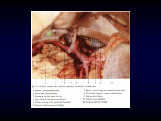 Basilar Artery