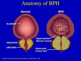 Anatomy of BPH
