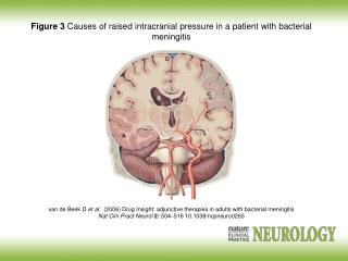Figure 3 Causes of raised intracranial pressure in a patient with bacterial meningitis