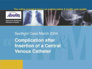 Spotlight Case March 2004