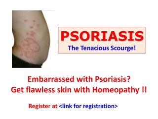 Embarrassed with Psoriasis? Get flawless skin with Homeopathy !!