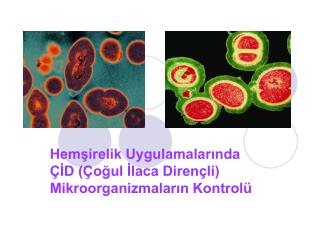 Hemşirelik Uygulamalarında ÇİD (Çoğul İlaca Dirençli) Mikroorganizmaların Kontrolü