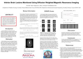 Inferior Brain Lesions Monitored Using Diffusion Weighted Magnetic Resonance Imaging