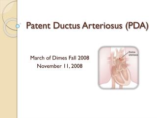 Patent Ductus Arteriosus (PDA)