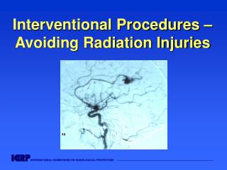 Interventional Procedures – Avoiding Radiation Injuries